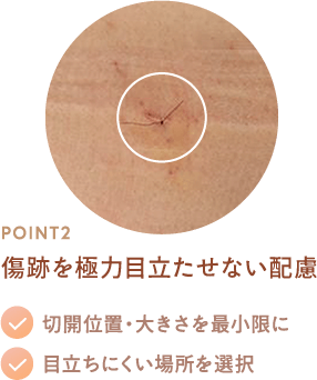 Point2 傷跡を極力目立たせない配慮