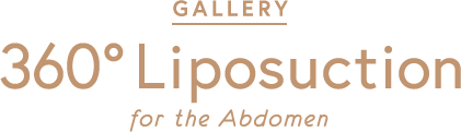 GALLERY 360° Liposuction for the Abdomen