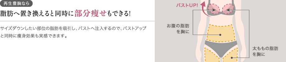 脂肪注入豊胸ならバストアップと同時に部分痩せも叶う！サイズダウンしたい部位の脂肪を吸引し、バストへ注入するので、バストアップと同時に痩身効果も実感できます。／お腹の脂肪を胸に／太ももの脂肪を胸に