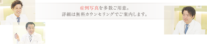 症例写真を多数ご用意。詳細は無料カウンセリングでご案内します。